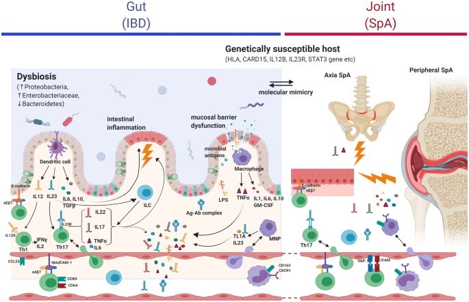 Defining The Phenotype Pathogenesis And Treatment Of Crohn S Disease Associated Spondyloarthritis Springerlink Defining The Phenotype Pathogenesis And Treatment Of Crohn S Disease Associated Spondyloarthritis Springerlink