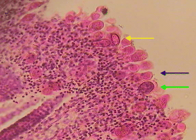 Concurrent Cryptosporidium And Candida Infections In A Buffalo Calf Bubalus Bubalis Springerlink