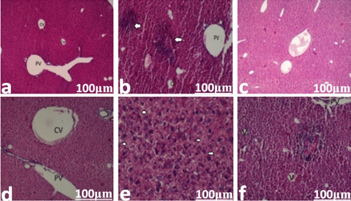 Sequential exposure to multiple antibiotics depleted glutathione in  hepatocytes, disrupted hematological profile, and inflammatory responses in  a mouse model | Comparative Clinical Pathology