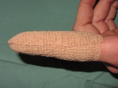 A useful dressing for isolated digit injuries | European Journal of  Orthopaedic Surgery & Traumatology