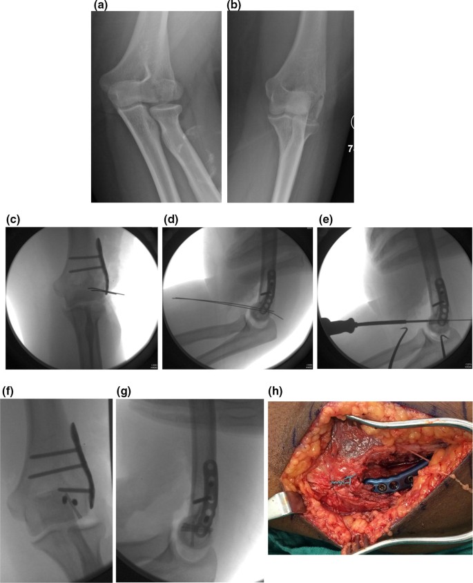 figure 14