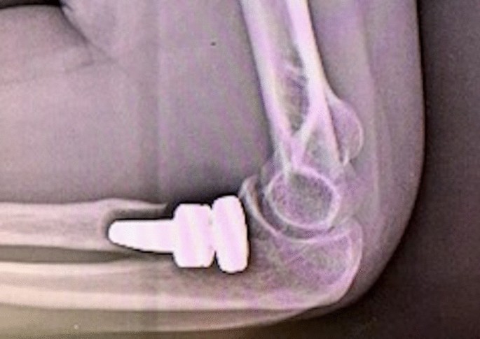 figure2