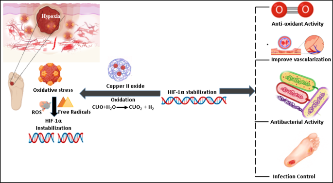 Therapeutic potential of copper II oxide in treating diabetic wounds ...