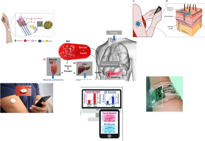 Insight into continuous glucose monitoring: from medical basics to 