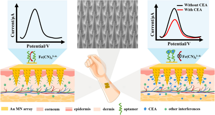 High-density AuNP-decorated microneedle electrochemical aptasensor for ...