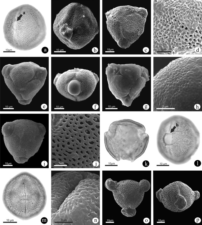 Electronic micrographs of pollen in studied subspecies of Linum