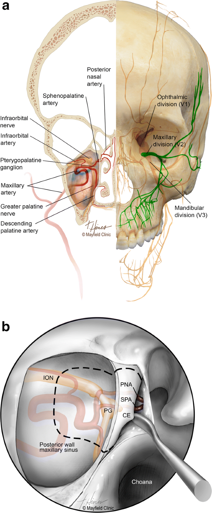 Endoscopic endonasal treatment of maxillary nerve (V2) painful neuropathy:  cadaveric study with clinical correlation | SpringerLink