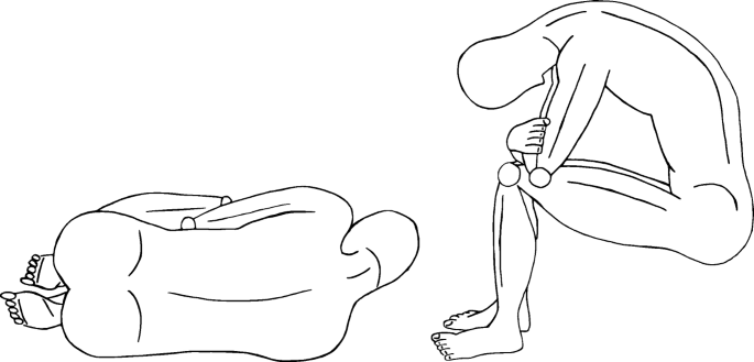 Lumbar Puncture Position Influences Intracranial Pressure Springerlink