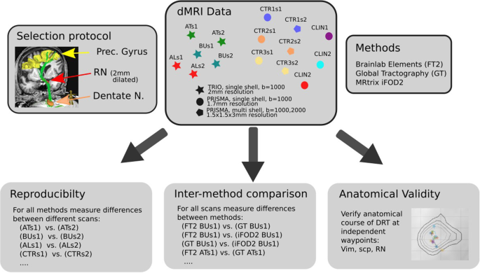 A Detailed Analysis Of Anatomical Plausibility Of Crossed And Uncrossed Streamline Rendition Of The Dentato Rubro Thalamic Tract Drt T In A Commercial Stereotactic Planning System Springerlink