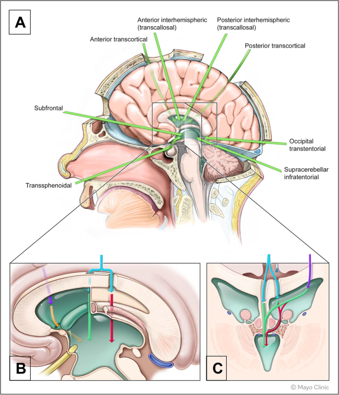 脳幹・基底核・小脳 (ビジュアル脳神経外科 Anatomy & Surgical Approach 3) 142 本・雑誌・漫画 脳幹・基底核・小脳 (ビジュアル脳神経外科