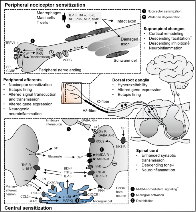 diabetic neuropathy mechanisms emerging treatments and subtypes