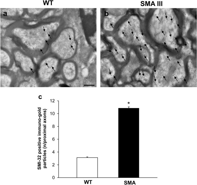 Ultrastructural Characterization Of Peripheral Denervation In A Mouse Model Of Type Iii Spinal Muscular Atrophy Springerlink