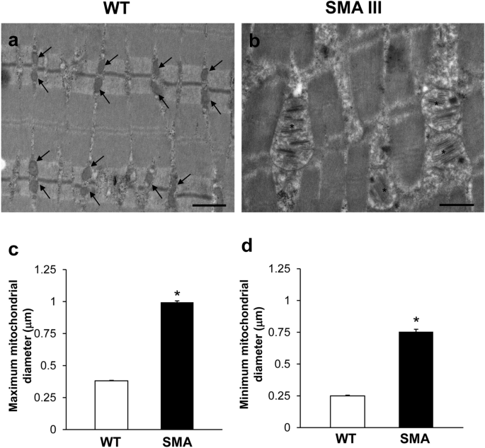 Ultrastructural Characterization Of Peripheral Denervation In A Mouse Model Of Type Iii Spinal Muscular Atrophy Springerlink