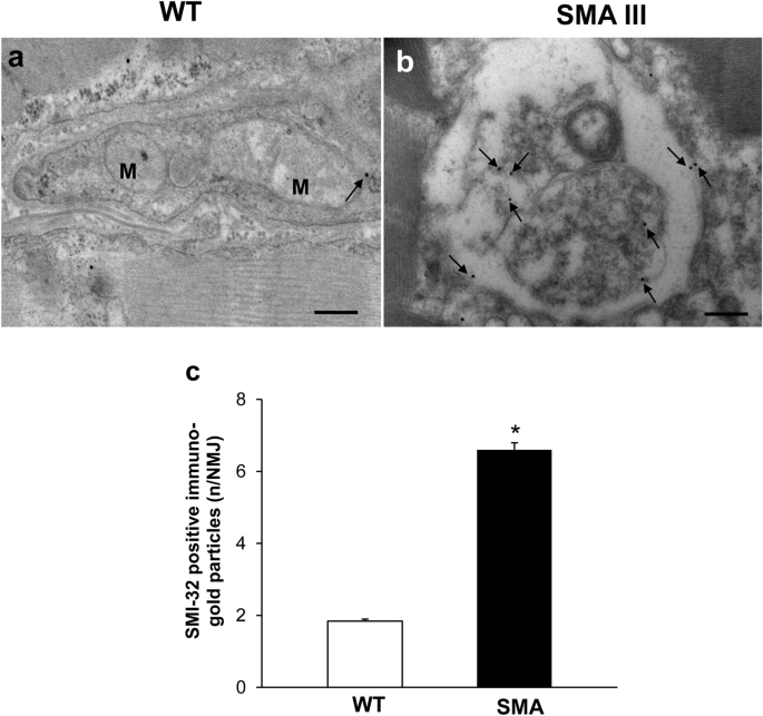 Ultrastructural Characterization Of Peripheral Denervation In A Mouse Model Of Type Iii Spinal Muscular Atrophy Springerlink