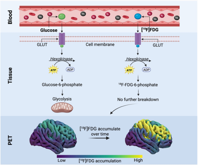 Cerebral glucose metabolism: the potential missing link in autism ...