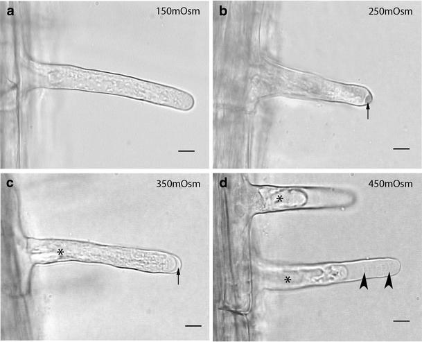 Plasmolysis And Cell Wall Deposition In Wheat Root Hairs Under Osmotic Stress Springerlink