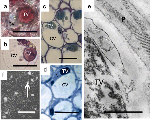 Q35. Why Do Plant Cells Possess Large Sized Vacuoles - Cellppt : Check spelling or type a new query.