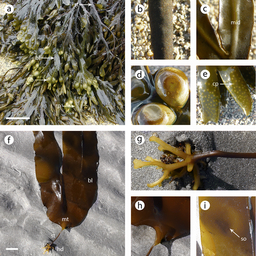 varicoza i laminaria de ce atunci când varicoase venele genunchi doare