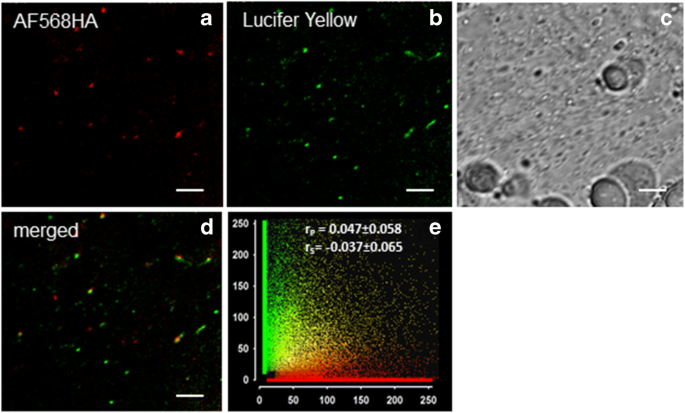 Fluid Phase And Membrane Markers Reveal Spatio Temporal Dynamics Of Membrane Traffic And Repair In The Green Alga Chara Australis Springerlink Fluid Phase And Membrane Markers Reveal Spatio Temporal Dynamics Of Membrane Traffic And Repair In The Green Alga Chara Australis Springerlink