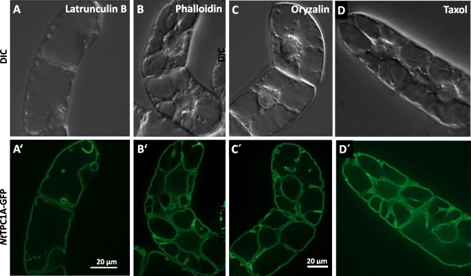 Tobacco two-pore calcium channel 1a is localised at the tonoplast, but acts  on events at the plasma membrane | Protoplasma