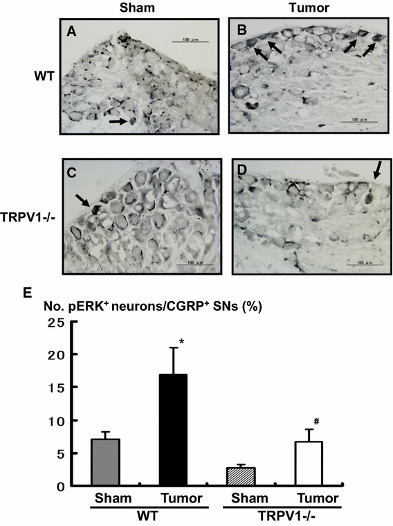 Decreased Sensory Nerve Excitation And Bone Pain Associated With Mouse Lewis Lung Cancer In Trpv1 Deficient Mice Springerlink