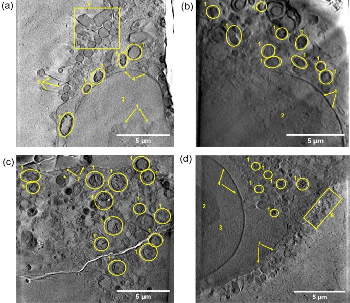 X Ray Tomography Of Cryopreserved Human Prostate Cancer Cells Mitochondrial Targeting By An Organoiridium Photosensitiser Springerlink