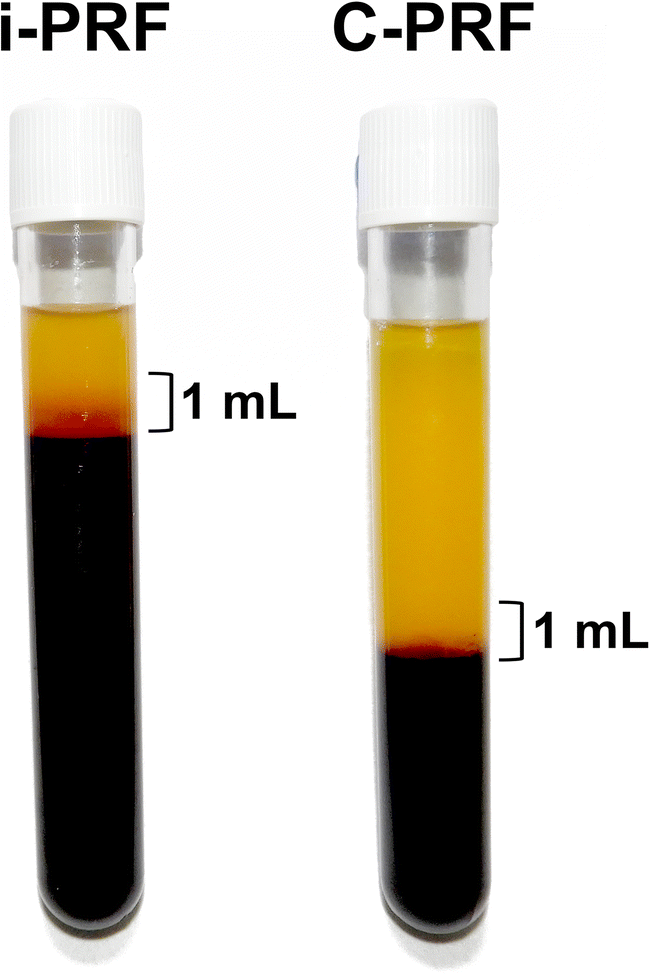 Improved Growth Factor Delivery And Cellular Activity Using Concentrated Platelet Rich Fibrin C Prf When Compared With Traditional Injectable I Prf Protocols Springerlink