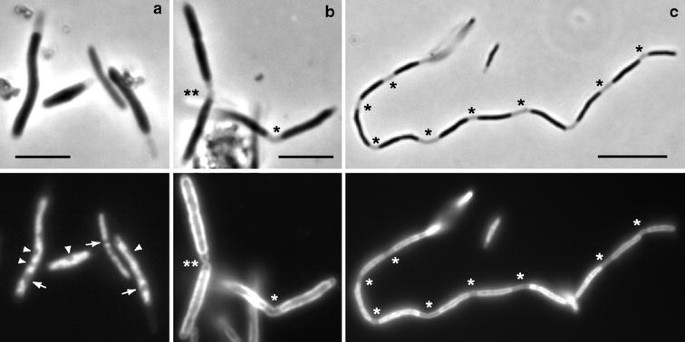 Microscopic Studies On Thermosipho Globiformans Implicate A Role Of The Large Periplasm Of Thermotogales Springerlink Microscopic Studies On Thermosipho Globiformans Implicate A Role Of The Large Periplasm Of Thermotogales Springerlink