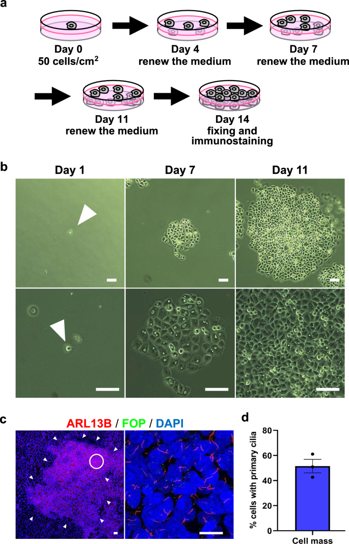A type of pancreatic cancer cells form cell clusters from a solitary ...