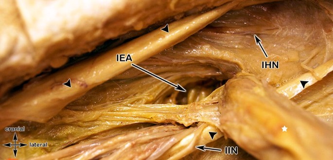 The inguinal region revisited: the surgical point of view | Hernia