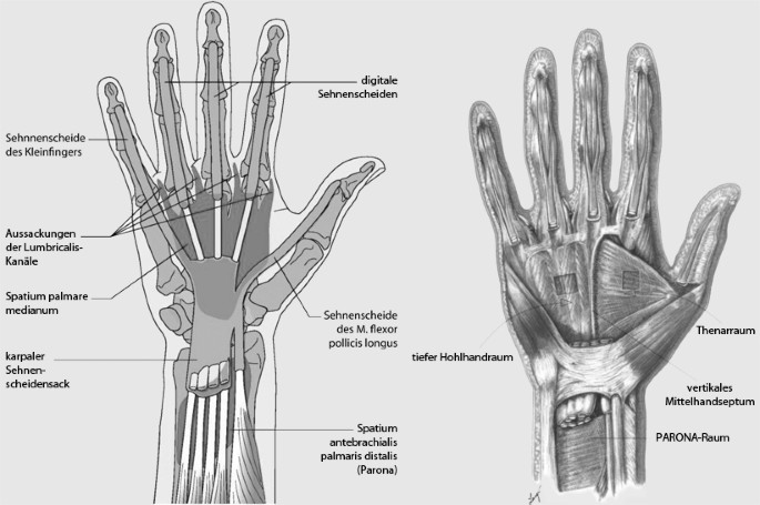Sehnenscheide entzündet handgelenk gips