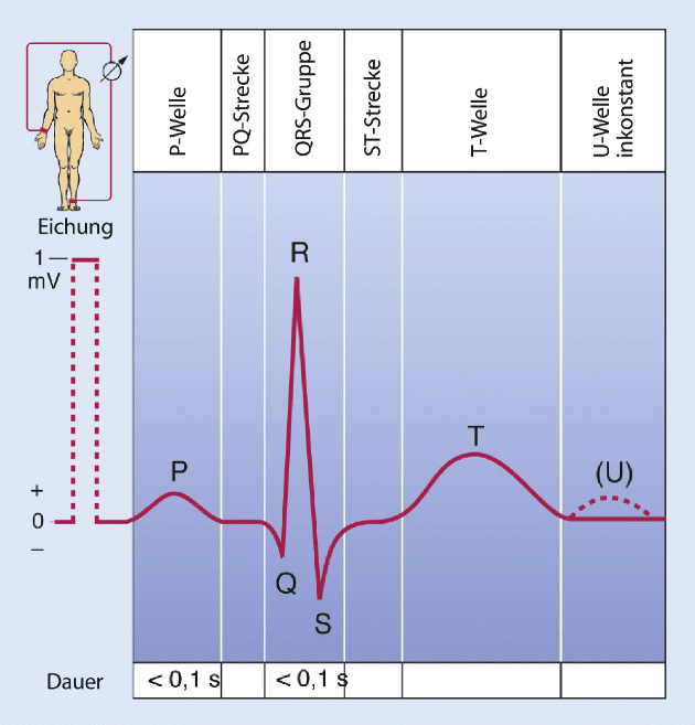 Notfall Ekg Springerlink