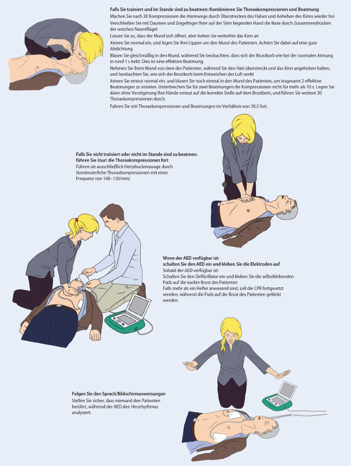 Basismaßnahmen zur Wiederbelebung Erwachsener und Verwendung  automatisierter externer Defibrillatoren | SpringerLink