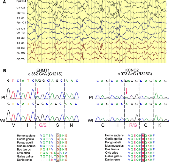 A mosaic maternal splice donor mutation in the EHMT1 gene leads to aberrant  transcripts and to Kleefstra syndrome in the offspring