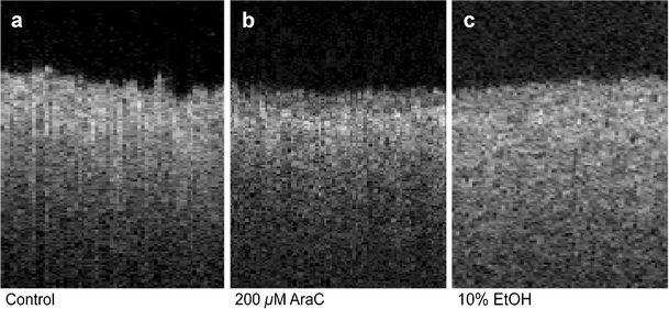 Apoptosis And Necrosis Induced Changes In Light Attenuation Measured By Optical Coherence Tomography Springerlink