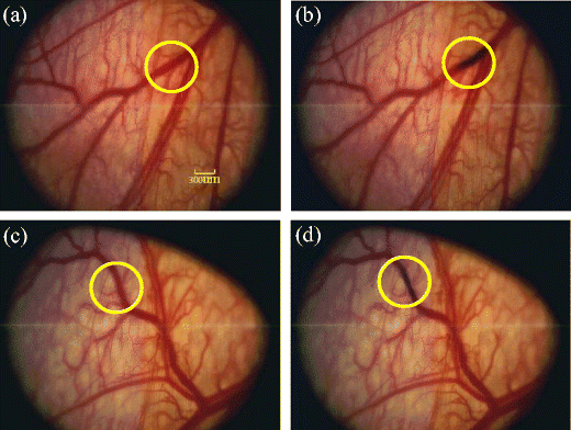 figure 16