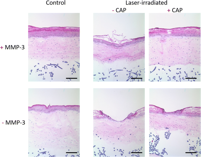 MMP-3 plays a major role in calcium pantothenate-promoted wound healing  after fractional ablative laser treatment | SpringerLink