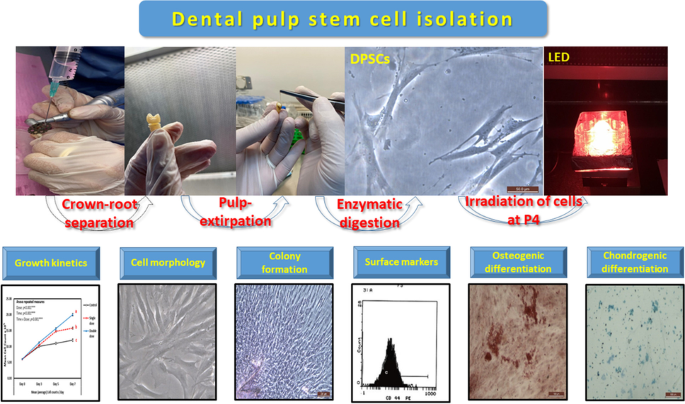 Photobiomodulation Treatment