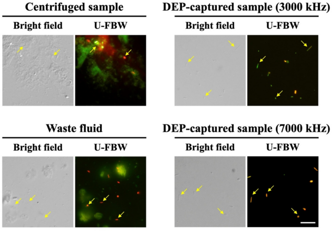Dielectrophoresis for Isolating Low-Abundance Bacteria Obscured by ...