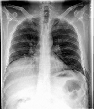 Scientific Educational Abstracts And Case Of The Day Presented At The Aser 2015 Annual Scientific Meeting And Postgraduate Course September 16 19 Miami Florida Springerlink