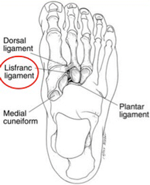 lisfranc ligament