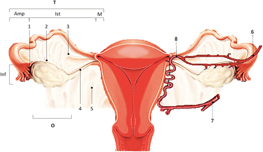 What Every Radiologist Should Know About Adnexal Torsion Springerlink