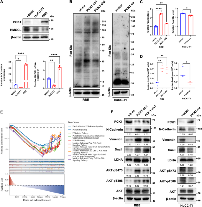 Pck1 PCK1 attenuates intrahepatic cholangiocarcinoma progression by ...