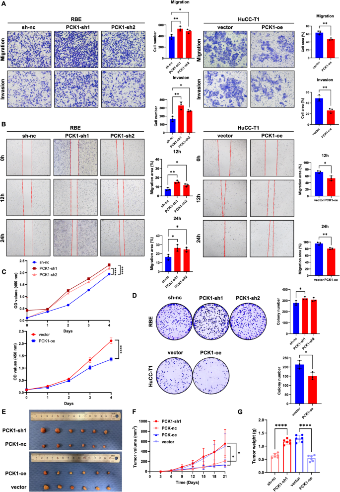 Pck1 PCK1 attenuates intrahepatic cholangiocarcinoma progression by ...