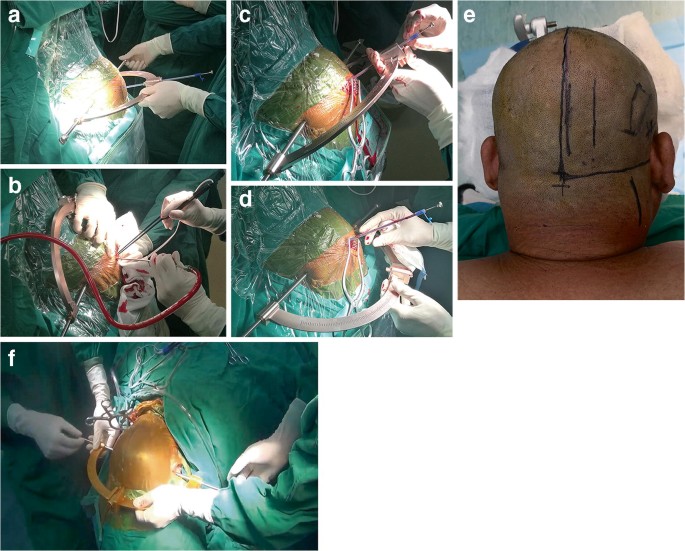 Graham Field Dura -Gel SPP (Skin Protection and Positioning) Graham Field Dura -Gel SPP (Skin Protection and Positioning)