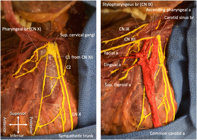 The pharyngeal plexus: an anatomical review for better understanding  postoperative dysphagia | SpringerLink
