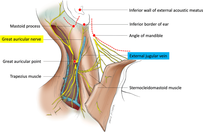 A Comprehensive Review Of The Great Auricular Nerve Graft Springerlink
