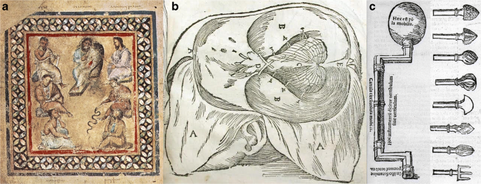 gravitate i vene varicoase geli varicoza în timpul sarcinii