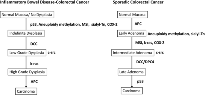 colorectal cancer ibd)