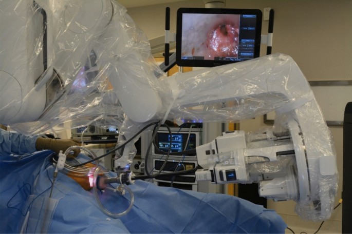 First Clinical Experience With Single Port Robotic Transanal Minimally Invasive Surgery Sp Rtamis For Benign Rectal Neoplasms Springerlink